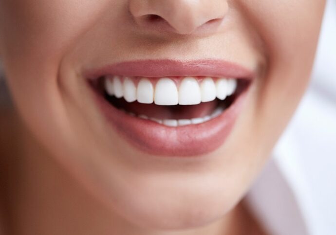 Teeth Whitening Dentist