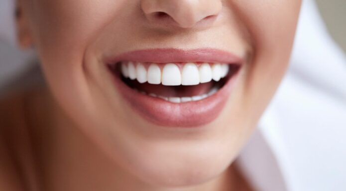 Teeth Whitening Dentist