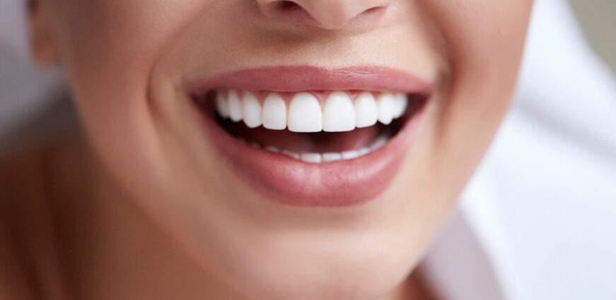 Teeth Whitening Dentist